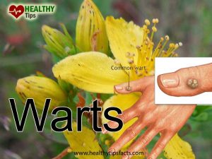 warts appear